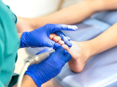 Ayak hastalıkları tedavisine yakın çekim. Seçici odak