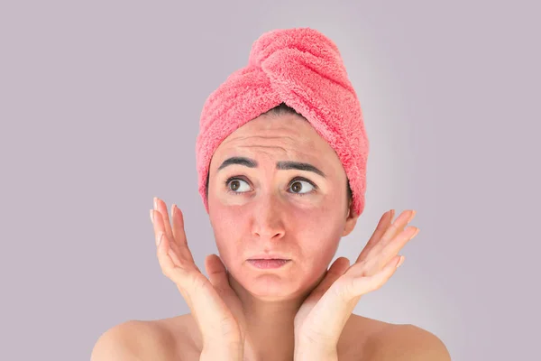 Droevig Gezicht Van Jonge Vrouw Met Huidirritatie Roodheid Huidproblemen Acne — Stockfoto