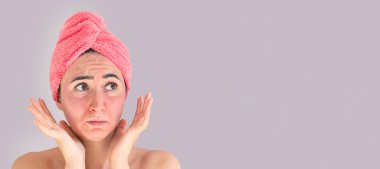 Cildinde tahriş, kızarıklık, deri sorunları, sivilceler, kızarıklık ya da gri arka planda güneş yanığı olan genç bir kadının üzgün yüzü. Cilt tedavisi kavramı