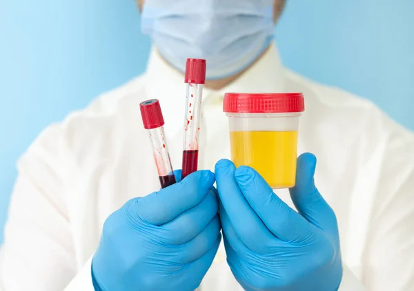 Doktor idrar ve kan örneklerini yakın çekim için tutuyor.