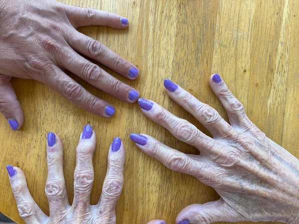 An elderly woman manicures her hands with her grandson, both with purple polished fingernail manicures.