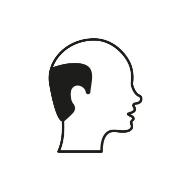 Kılsız Erkek Siyah Simgesi. Kel adam silueti çizimi. Saç Kaybı, Alopecia Tıbbi Problem Simgesi. İzole Vektör İllüstrasyonu