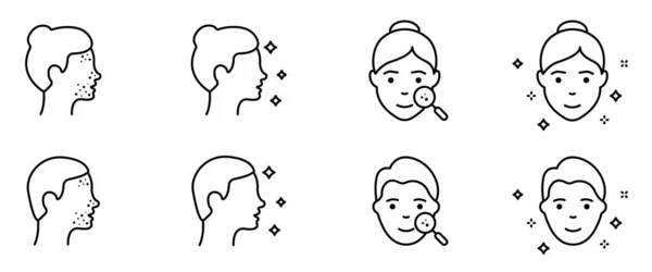 女性与男性的面孔 采购产品脸上的粉刺 拉什线图标集 有漂亮脸蛋的女孩和男孩 皮肤病 发炎皮肤 病媒图解 — 图库矢量图片