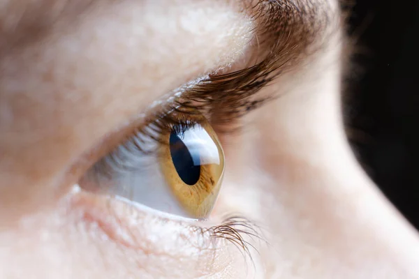 Macro foto del ojo humano con queratocono enfermedad de la córnea —  Fotos de Stock