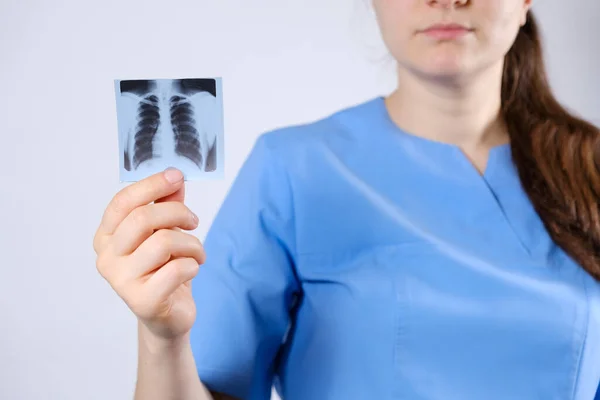 一名身穿蓝色制服的医生展示了一张荧光透视照片，一张用于预防和早期诊断结核病的肺X光照片. — 图库照片