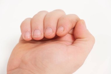 Beyaz arka planda yeniden büyümüş tırnak eti olan dağınık erkek tırnakları.