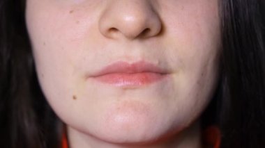 Temporomandibular eklem bozukluğu olan bir kadın ağzını açar ve kapatır. Alt çene yana kayar..