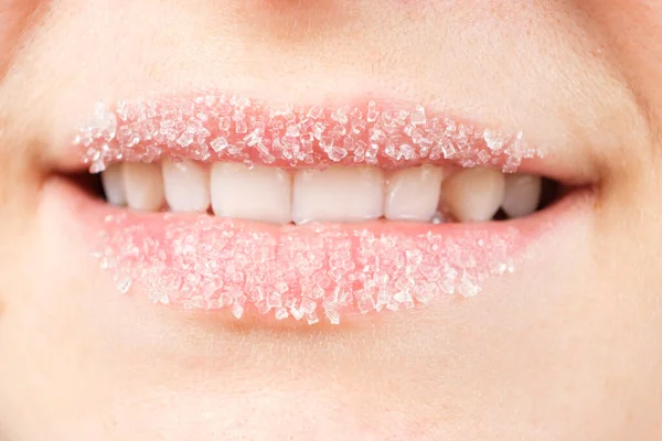 Makrofotografie von Frauenlippen mit Zuckerpeeling, Lippenpflege, Peeling der Lippenhaut — Stockfoto