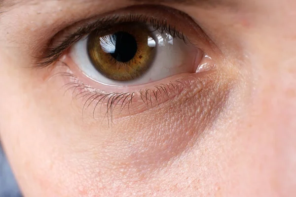 Una foto macro dell'occhio umano è un livido sotto l'occhio, uno sguardo stanco — Foto Stock