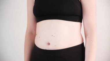 Kadının karnı şişmiş. Kilo verme kavramı