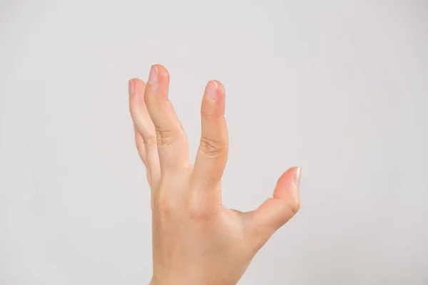 Human Hand Unnaturally Bent Joint Ankylosis Joints Hand — Zdjęcie stockowe