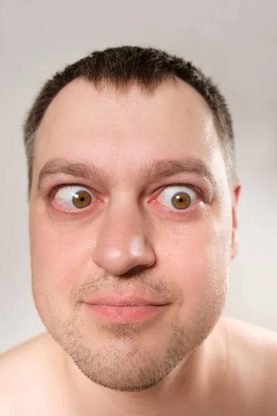 Man Strabismus Squints His Eyes White Background — Stok fotoğraf