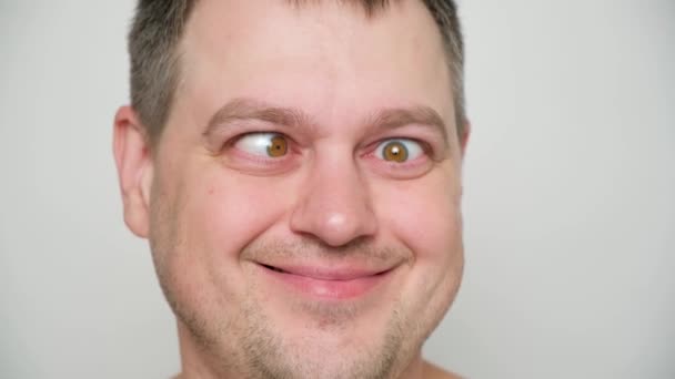 Strabismus Şaşı Bir Adam Gözlerini Beyaz Bir Arkaplana Dikti — Stok video