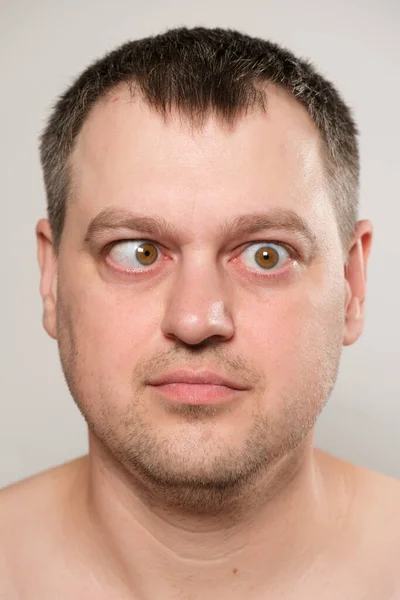 Een Man Met Strabismus Knijpt Zijn Ogen Een Witte Achtergrond — Stockfoto