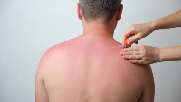 Applying Therapeutic Ointment Skin Person Sunburn Close — Video