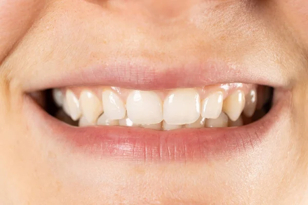 Düz Dişleri Olan Güzel Bir Kadın Gülümsemesi — Stok fotoğraf