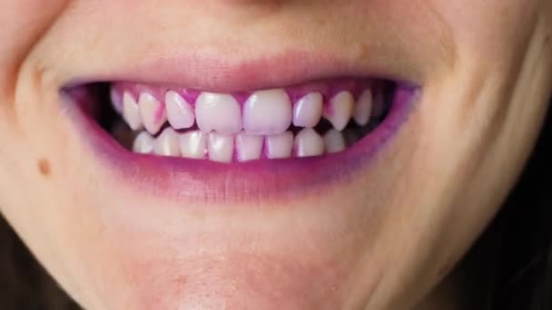 Placa Los Dientes Humanos Color Rosa Con Tabletas Indicadoras — Vídeos de Stock