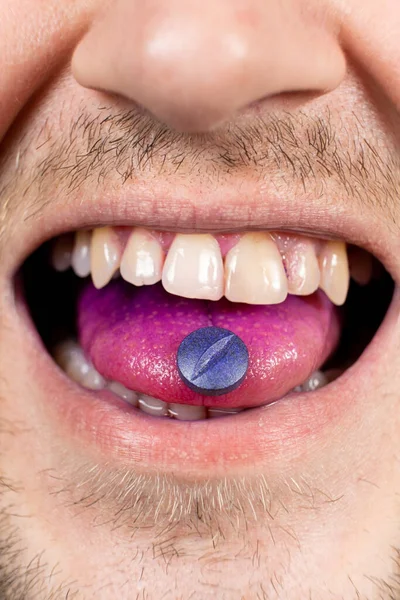 A person shows an indicator pill on his tongue to determine plaque