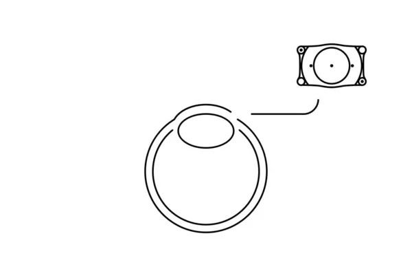 Ilustrace Icl Intraocular Contact Lens Chirurgie Vložení Icl — Stockový vektor