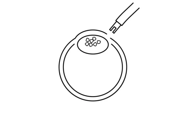 Processo Cirúrgico Catarata Ilustração Desenho Linha Sugando Lente Nublada —  Vetores de Stock