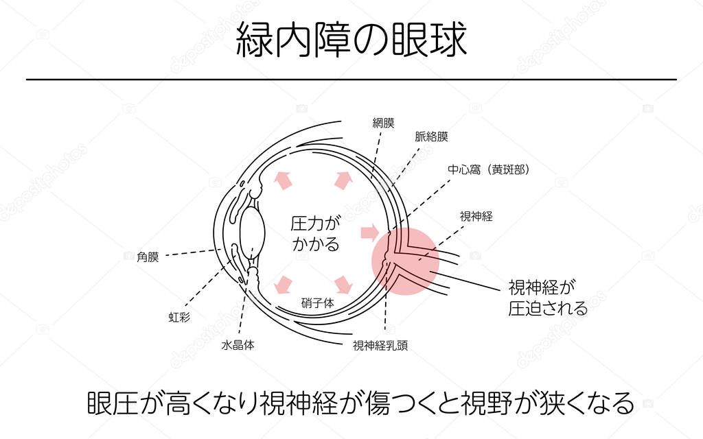 Illustration, of the eye, Medical Illustrations. Translation in the eye