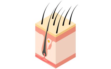 Saçın resimsel çizimi, enine kesitin izometriği