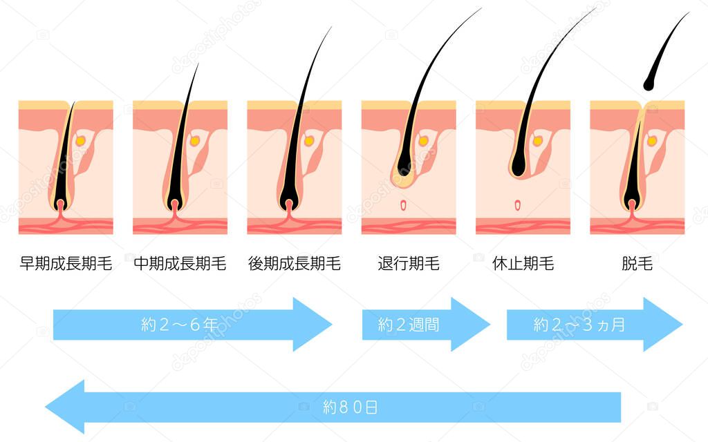 Illustration of the hair cycle and hair growth cycle - Translation: Early growth phase, middle growth phase, late growth phase, regression phase, resting phase, hair removal