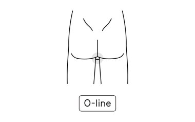 Erkek tüyü temizleme, O-Line, çıplak vücut.