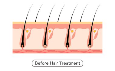 Image of hair removal, before and untreated hair