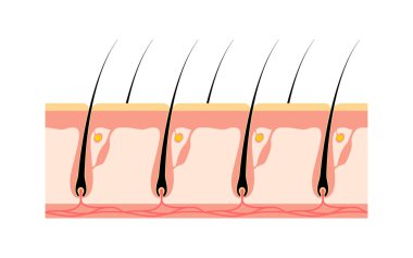 Image of hair removal, before and untreated hair