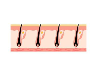 Image of hair removal, after hair removal, self-treated