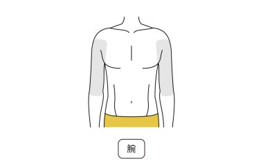 Erkek tüyü çıkarma alanı, üst kol.