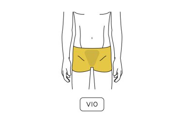 Erkeklerin tüy dökücü bölgesi, VIP.