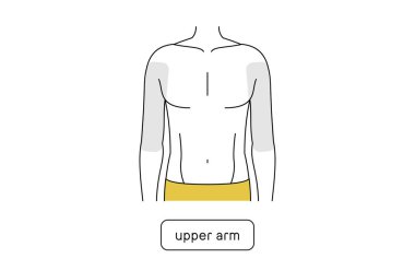 Erkek tüyü çıkarma alanı, üst kol.