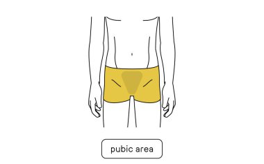 Erkeklerin tüy dökücü bölgesi, VIP.