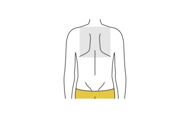 Erkek tüyü çıkarma alanı, sırtının üst kısmı.