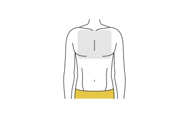 Erkeklerin tüy çıkarma alanı, tüm göğüs.