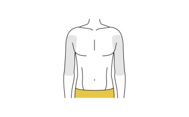 Erkek tüyü çıkarma alanı, üst kol.