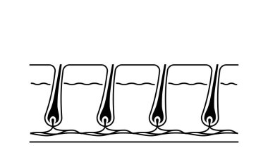 Tüyleri alındıktan sonra, kendi kendini tedavi etme görüntüsü.