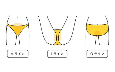 Hair Removal Illustrations for Women VIO - Translation: V-Line, I-Line, O-Line
