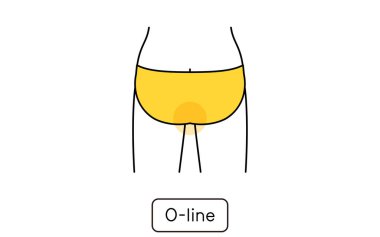 Hair removal illustration for women by part, O line