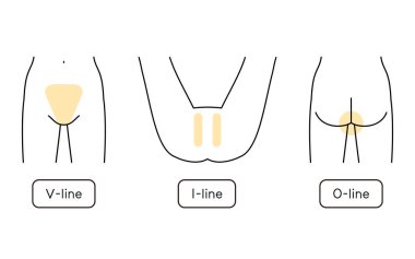 Hair Removal Illustrations for Women VIO