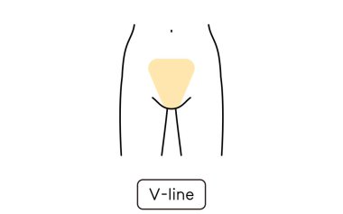 Hair Removal Illustrations for Women by Part 