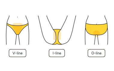 Hair Removal Illustrations for Women VIO