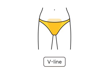 Hair Removal Illustrations for Women by Part