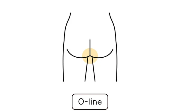 Hair Removal Illustration Women Part Line — Wektor stockowy