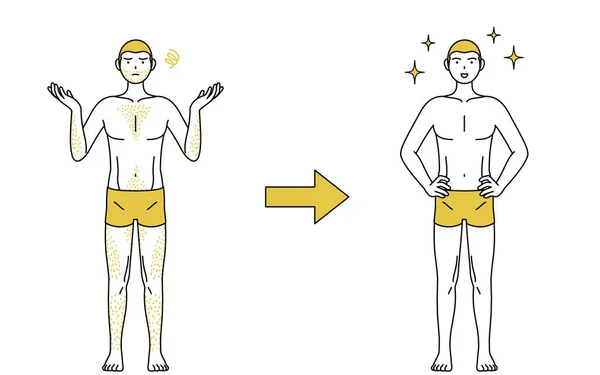 Imagem Depilação Médica Antes Depois Homem Com Pêlos Grossos Que —  Vetores de Stock