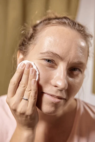 Tägliche Gesichtspflege Eine Frau Mit Post Akne Verwendet Toner Und — Stockfoto