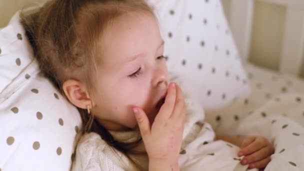 一个咳嗽的病童躺在温暖的毯子下躺在床上 季节性呼吸道疾病 一个两岁的小女孩咳嗽时用手捂住嘴 — 图库视频影像