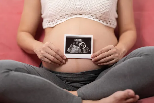Close Gelukkig Zwanger Vrouw Met Ultrasoon Beeld Strelen Grote Buik — Stockfoto